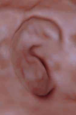 échographie oreille troisième trimestre